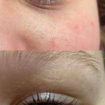 Ресницы и брови, в Томске