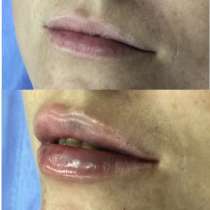 Уходовые процедуры, в Краснодаре