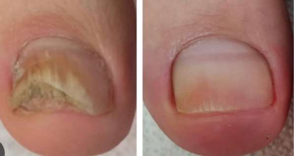 Подолог в Краснодаре