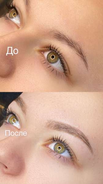 Брови в Черняховске