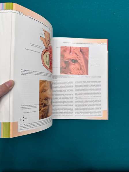 Медицинская литература. Учебник по хирургии в Санкт-Петербурге фото 4