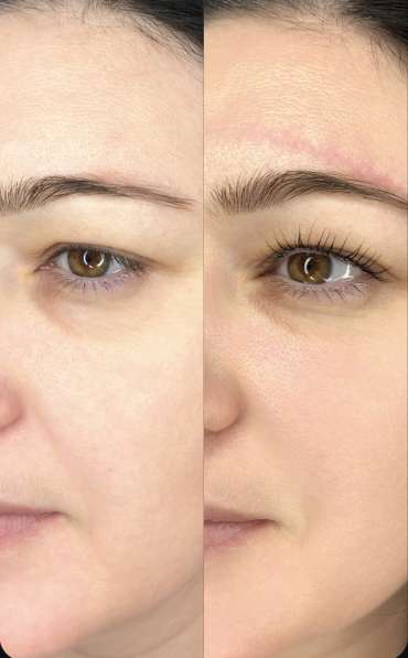 Ламинирование ресниц в Барнауле фото 8