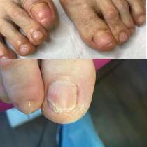 Подолог, в Москве