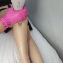 Лазерная эпиляция (Александритовый Candela), в Москве